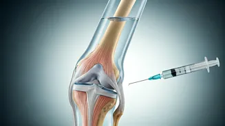 Can Knee Injections Delay Knee Replacements?