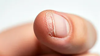 Nail Troubles? Decoding Peeling Nails & Solutions