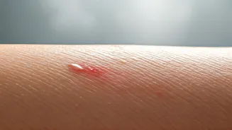 Humidity Can Damage Your Skin More Than You Think