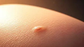Summer Skin Savvy: Decoding Acne Stages & When to See a Dermatologist