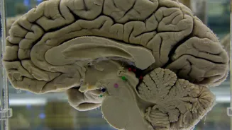 Related Stories banner