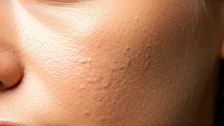 Why Your Makeup Looks Patchy By Noon