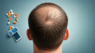 Gen Z Men's Early Hair Loss: Experts Link It to Modern Lifestyle, Not Just Genetics