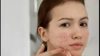 “I Wash My Face More in Summer, But Why Am I Getting More Pimples?”: Dermatologist Reveals Why Your Routine Needs a Reset