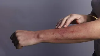 Fix forearm itching with these remedies