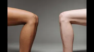 Inner-thigh chafing in early-monsoon humidity: 3 simple fixes Indian doctors quietly recommend