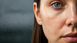 Why Rainy Weather Isn't Always Skin Friendly