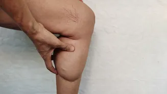 Pernas e pés inchados? Médica explica o que eles podem indicar