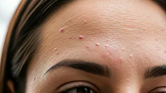 Monsoon Humidity Can Trigger Breakouts—What To Do