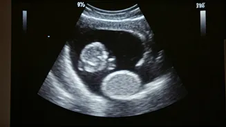 Baby's First Smile? Ultrasound Captures Unborn Child Responding to Dad's Voice in Viral Clip