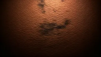 Dark Skin Patches May Signal Blood Sugar Issues