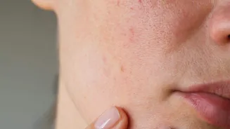 Home remedies to fix mild facial redness