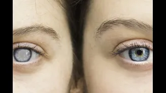 Daily Habits That Can Slow Or Accelerate Glaucoma Progression