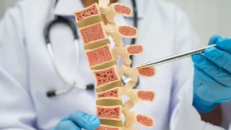 Osteoporose: médica alerta para sinais que surgem muito antes da primeira fratura