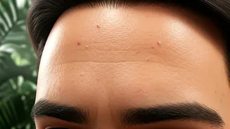 Monsoon Skin Issues Start With Rising Humidity