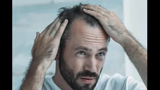 Gen Z Men Are Losing Hair In Their 20s And Experts Say Lifestyle Is To Blame
