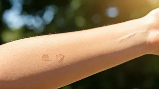 Beat the Heat: 5 Dermatologist-Approved Ways to Shield Your Skin This Summer!