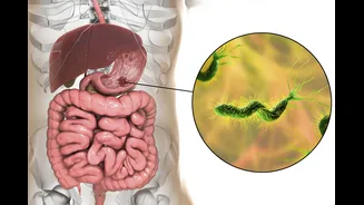 Gastroenterologista lista formas mais comuns de infecção da H. pylori