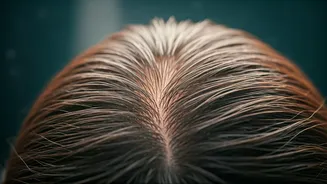 Monsoon Hair Woes Begin With An Oily Scalp