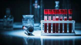 5 Blood Tests to Unlock Weight Loss in India