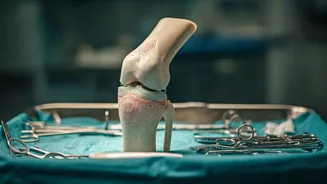 Knee Replacement Recovery: Reduce Pain & Heal Faster