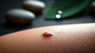 5 Quick Home Hacks to Tame Stubborn Cystic Pimples Overnight