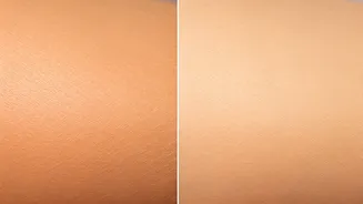 The Truth About Tanning: Ditching the Bronze for a Healthier Glow