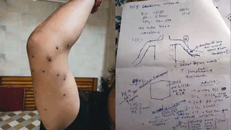 Delhi Police say pellets not used; hospital report contradicts claim