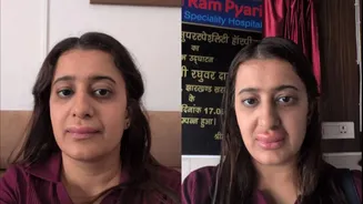 Woman Claims She Got 'Severe' Allergy, Her Son Suffered From Diarrhoea After Eating On Vande Bharat Train