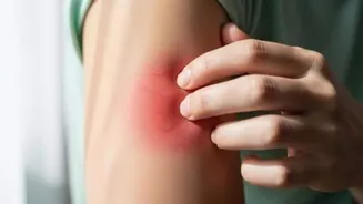 Debunking all myths about blisters