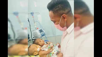 Nascidos unidos pelo abdômen, gêmeos siameses morrem em Goiânia.Vejavídeo