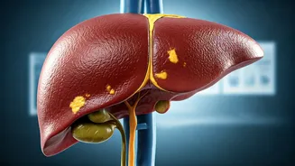 India's Silent Liver Epidemic: Fatty Liver Disease Surges Amidst Obesity and Diabetes Rise