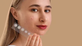 Adesivos para espinhas funcionam mesmo? Dermatologista responde