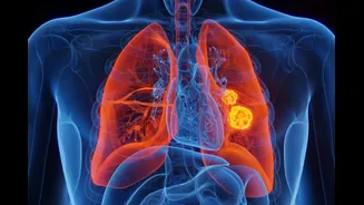 Pollution Behind Lung Cancer Rise? Cases Increasing In India Even Where Smoking Is Low, Says Study