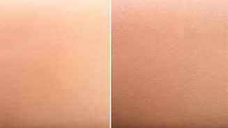 Over-Exfoliation Can Trigger Redness And Sensitivity