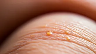 Xanthelasma: Tiny Yellow Eyelid Bumps Signaling Deeper Heart Health Concerns