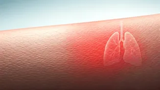 Eczema's Hidden Link: How Untreated Skin Condition May Lead to Chronic Asthma