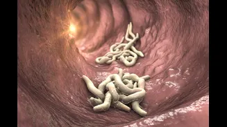 Gastroenterologista cita sinais que podem indicar vermes no intestino