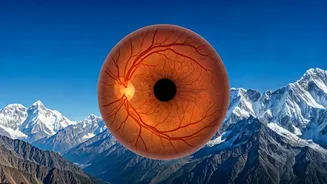 High-Altitude Vision Loss: A Trekker's Guide