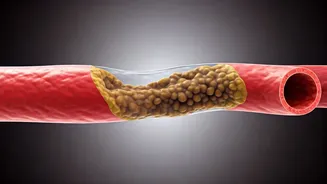 Eating Breakfast Helps Keep Arteries Healthy