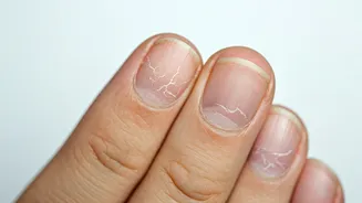 Buldhana Villagers' Nail Issues: What's Happening?