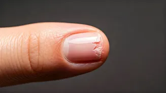 Nail Troubles? Discover Causes, Cures, & Prevention!