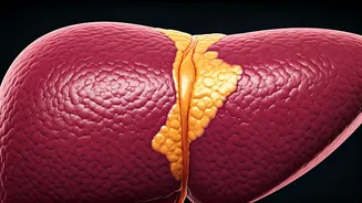 India's Silent Liver Threat: New Guidelines Tackle Fatty Liver in Diabetics
