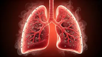 Air Pollution's Deadly Link: How PM2.5 Worsens Dengue Fatality Rates Globally