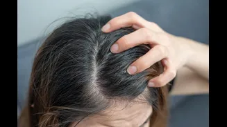 A caspa apareceu? Como tratar a dermatite seborreica