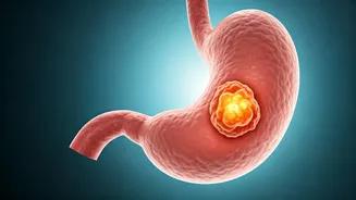 Rising Cancer Rates: Obesity's Link Across Age Groups