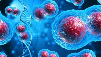 AI cuts radiotherapy planning time from weeks to hours in cancer treatment trial