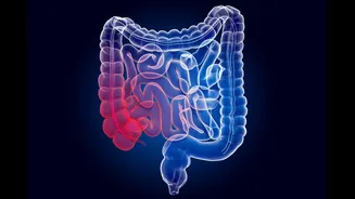 Expert lista hábitos diários para recuperar a microbiota intestinal