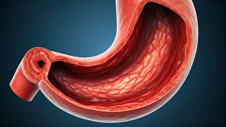 Frequent Acidity: Don't Ignore the Alarm Bells!