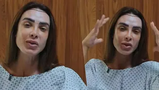Transplante capilar sem raspagem: como funciona a técnica, escolhida por Nicole Bahls
